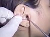 Her Ear Contents Are What Nightmares Are Made Of