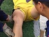 Soccer Players Knee Is Disturbingly Reset On The Pitch