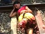 Woman Lies There Calmly After Losing Her Legs In A Shocking Accident
