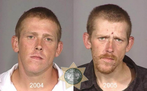 Before And After Meth 01