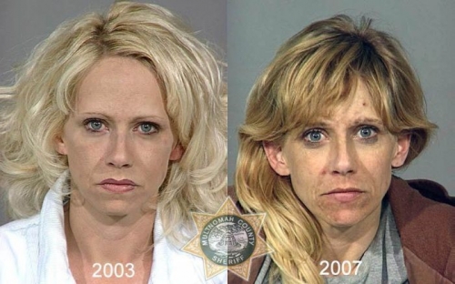 Before And After Meth 02