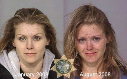 Before And After Meth 04