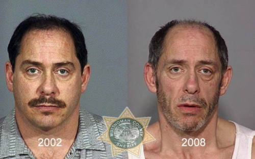 Before And After Meth 05