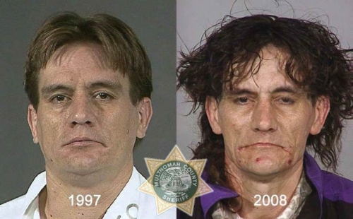 Before And After Meth 06