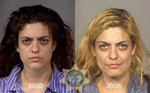 Before And After Meth 07