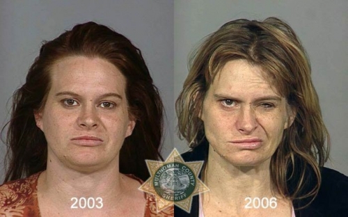 Before And After Meth 08