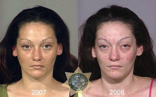 Before And After Meth 09