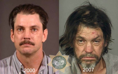 Before And After Meth 10