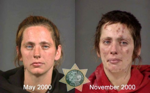 Before And After Meth 12