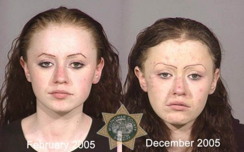 Before And After Meth 13