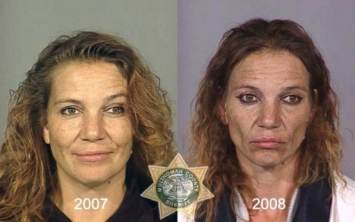 Before And After Meth 14