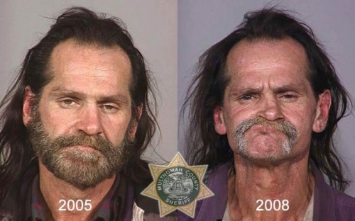 Before And After Meth 15