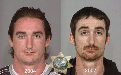 Before And After Meth 16