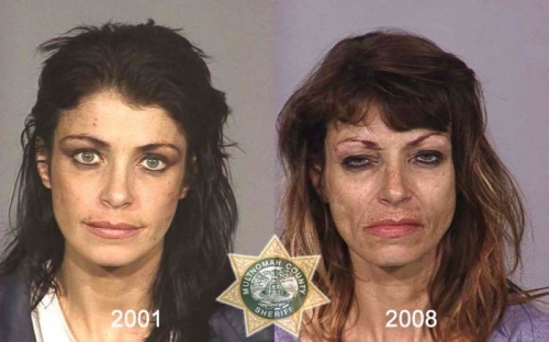 Before And After Meth 19