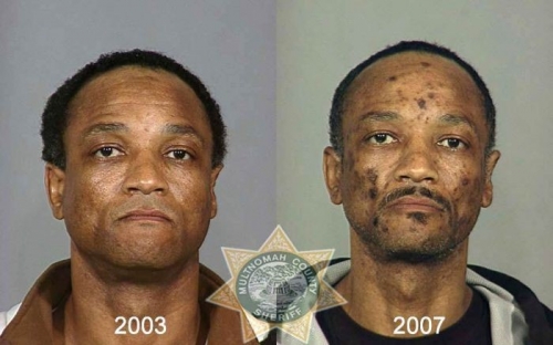 Before And After Meth 21