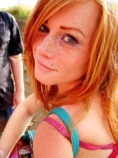 Redheads 30