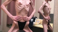 Skinny Is The New Ugly