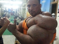 Synthol Abusers 11