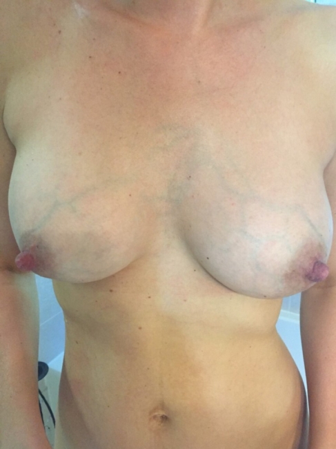 Veiny Breasts 29