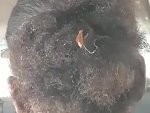 Bus Passenger Doesn't Realise She Has A Bug Colony In Her Hair
