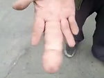 Dick Finger
