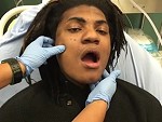 Doctor Expertly Realigns A Dislocated Jaw
