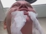 Girl Losing Her Mind After Dental Surgery
