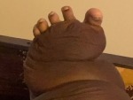I Find This Fat Foot Very Confronting
