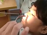 Little Girl Patiently Has A Parasite Removed From Her Nose
