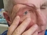 Man Tests Out His New Facial Prosthetic Whoa
