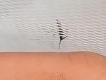 Mosquito At Work Wow
