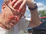 Old Guy Clubs A Cyclist In A Bloody Road Rage
