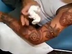 Poor Guy Has A Bad Reaction To Tattoo Ink
