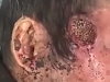 Poor Mofo Actually Has Maggots In His Head