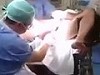 Surgeon Called Into To Remove Something Unexpected From A Butt
