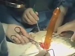 Surgeons Perform A Pretty Unusual Surgery
