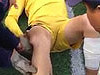 They Reset The Poor Guys Popped Knee And Its Brutal