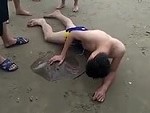 Tourist Got Stung And Stuck To A Stingray
